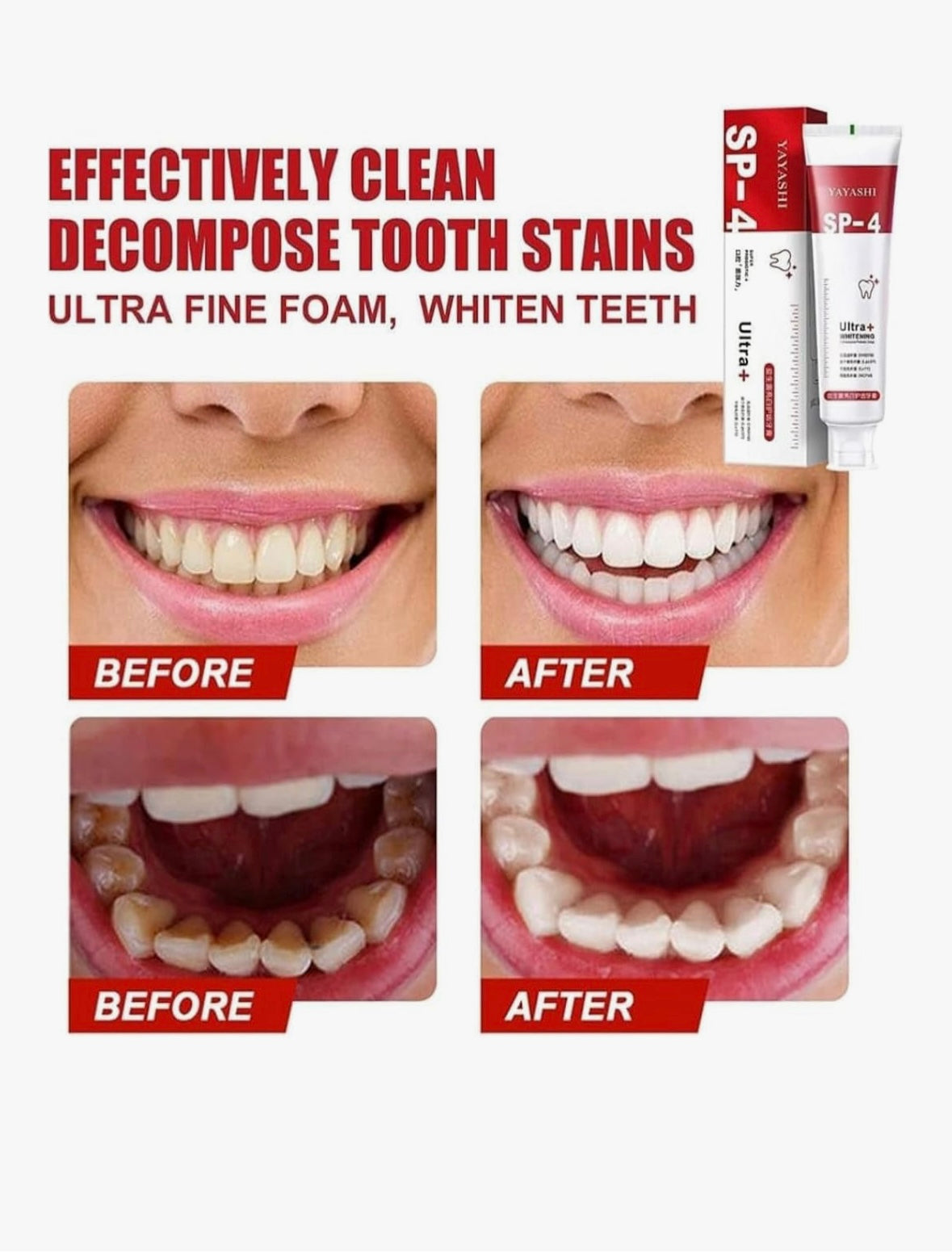 Teeth whitening Toothpaste